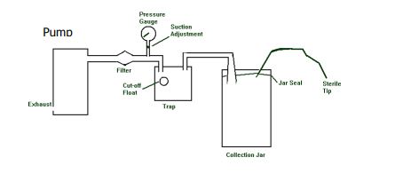 Nguyên lý hoạt động của máy hút dịch y tế - thiết bị y tế giá gốc