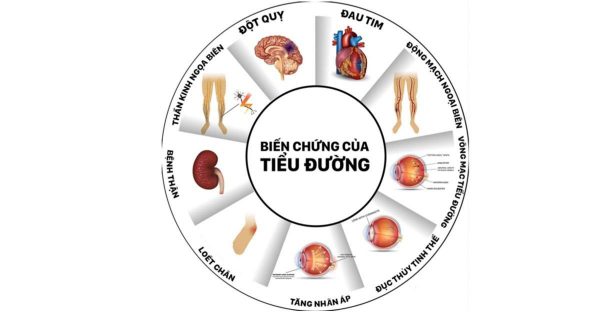 biến chứng của tiểu đường - Thiết bị y tế giá gốc