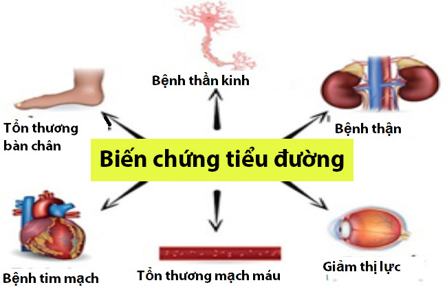 Các biến chứng của bệnh tiểu đường - Thiết bị y tế giá gốc